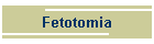 Fetotomia